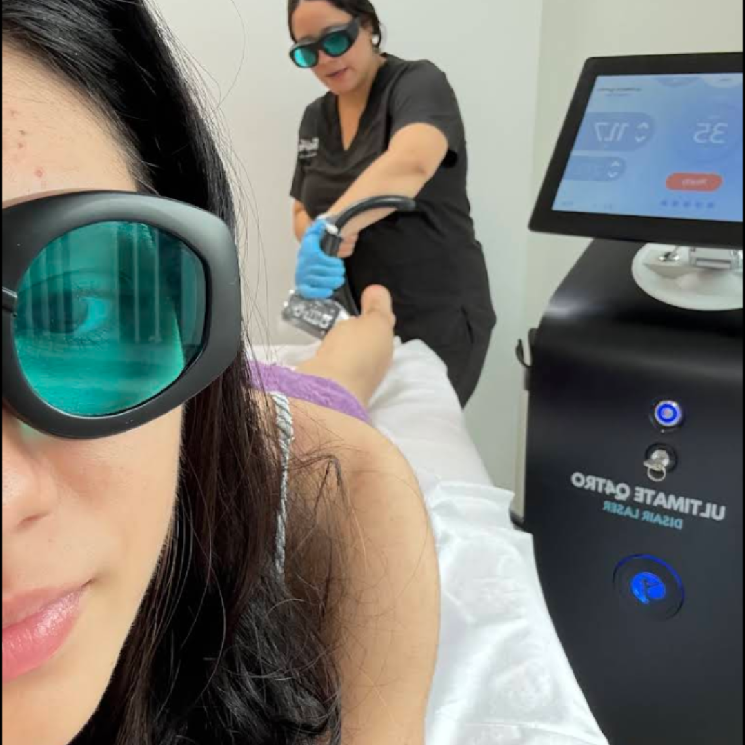 Tratamiento de depilación láser